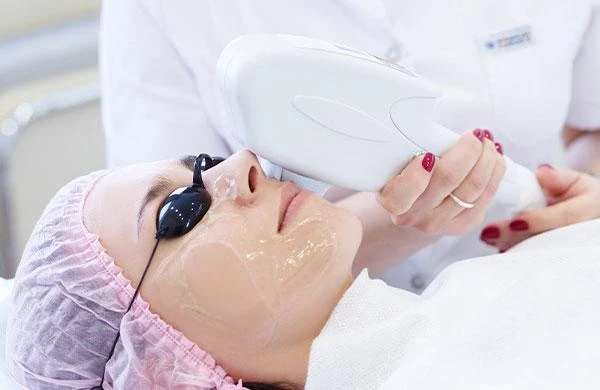 Bắn IPL trẻ hoá da nâng cơ có thật sự hiệu quả | La Hues Clinics